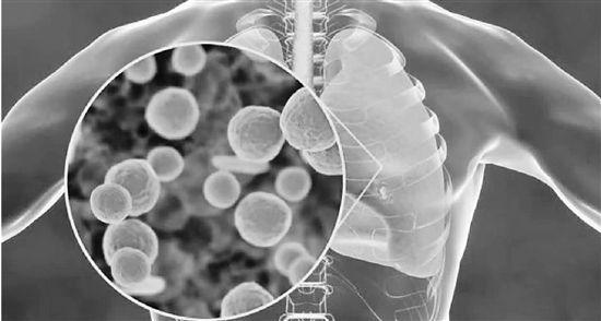 肺炎支原体引起肺部感染 据“华山感染”微信公众号