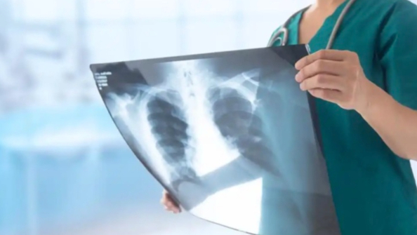 跨省就医有望不用重复拍片了？